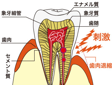 質 セメント